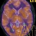 The Whole Brain Atlas